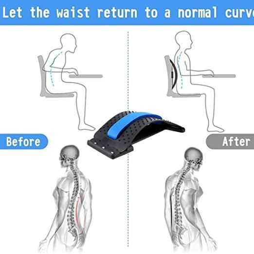 💪 Smart Posture Corrector & Spine Stretcher – Magic Back Support for Instant Comfort ⚡💆‍♂️